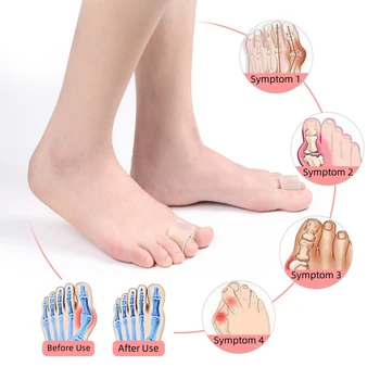 Kojų Orthotics Pėdų Priežiūros Priemonė Kojų Splitter Sutampa Kojų Separatorius Pluošto Toe Dangtelį Kojų Korekcijos Įrankis Toe Dangtelį